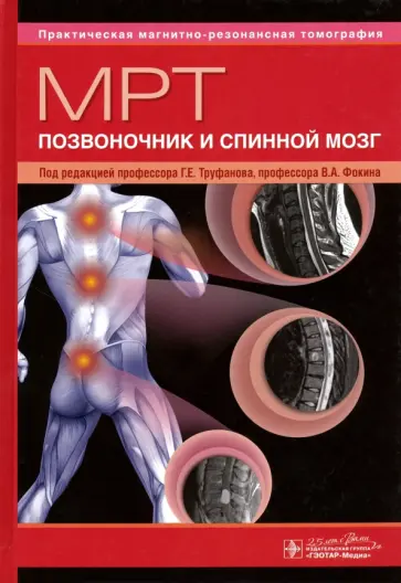 Труфанов, Фокин - МРТ. Позвоночник и спинной мозг Труфанов, Фокин - МРТ. Позвоночник и спинной мозг обложка книги