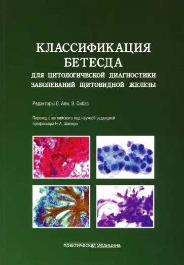 Классификация Бетесда для цитологической диагностики заболеваний щитовидной железы. Терминология обложка книги