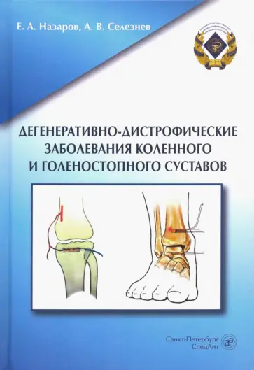 Назаров, Селезнев - Дегенеративно-дистрофические заболевания коленного и голеностопного суставов обложка книги
