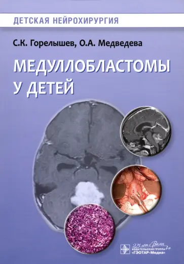 Горелышев, Медведева - Медуллобластомы у детей. Руководство обложка книги