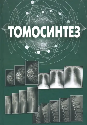 Александр Васильев - Томосинтез Александр Васильев - Томосинтез обложка книги