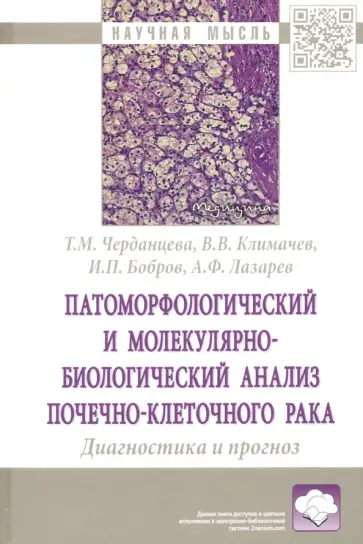Черданцева, Климачев - Патоморфологический и молекулярно-биологический анализ почечно-клеточного рака.Диагностика и прогноз обложка книги