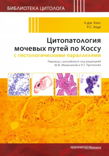 Косс, Хода - Цитопатология мочевых путей по Коссу с гистологическими параллелями обложка книги