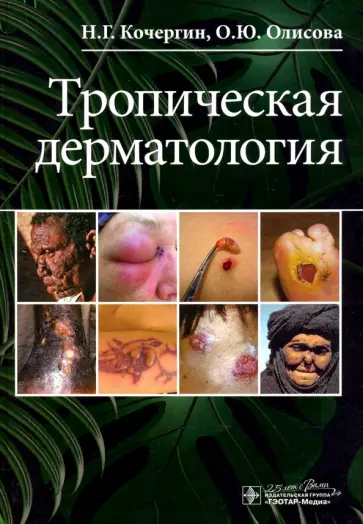 Кочергин, Олисова - Тропическая дерматология. Руководство Кочергин, Олисова - Тропическая дерматология. Руководство обложка книги