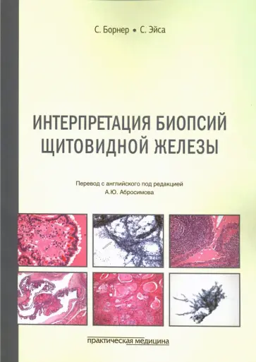 Борнер, Эйса - Интерпретация биопсий щитовидной железы обложка книги