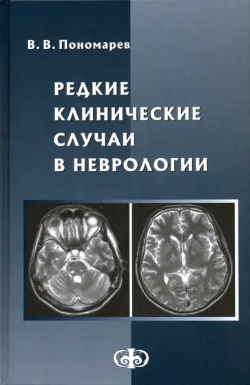 Владимир Пономарев - Редкие клинические случаи в неврологии (случаи из практики). Руководство для врачей обложка книги
