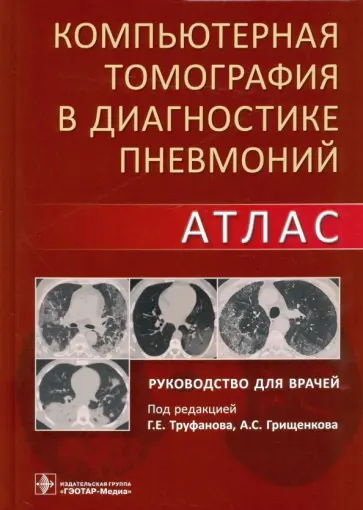 Геннадий Труфанов - Компьютерная томография в диагностике пневмоний. Атлас Геннадий Труфанов - Компьютерная томография в диагностике пневмоний. Атлас обложка книги