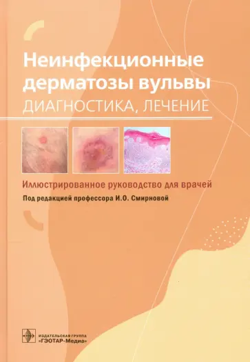 Смирнова, Белоусова - Неинфекционные дерматозы вульвы. Диагностика, лечение. Иллюстрированное руководство Смирнова, Белоусова - Неинфекционные дерматозы вульвы. Диагностика, лечение. Иллюстрированное руководство обложка книги