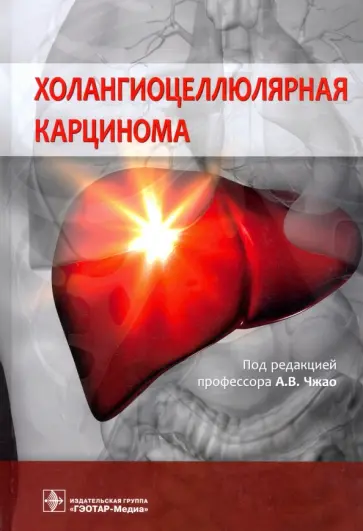 Чжао, Бугаев - Холангиоцеллюлярная карцинома Чжао, Бугаев - Холангиоцеллюлярная карцинома обложка книги