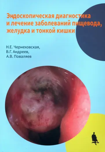 Чернеховская, Поваляев - Эндоскопическая диагностика и лечение заболеваний пищевода, желудка и тонкой кишки обложка книги