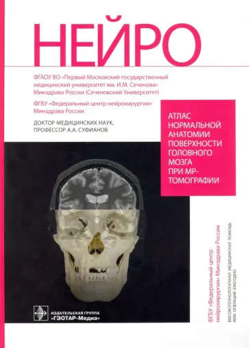 Суфианов, Мочалов - Атлас нормальной анатомии поверхности головного мозга при МР-томографии обложка книги