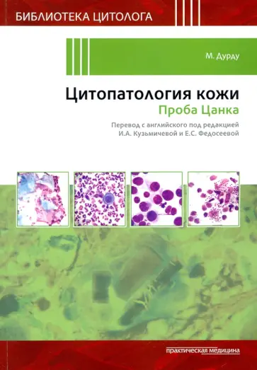 Мурат Дурду - Цитопатология кожи. Проба Цанка обложка книги