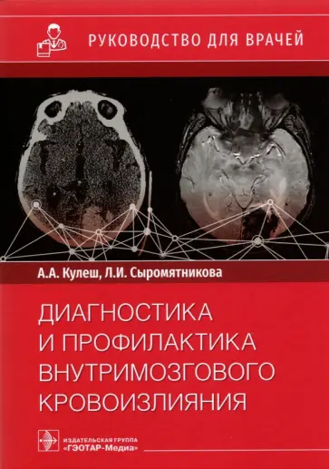 Кулеш, Сыромятникова - Диагностика и профилактика внутримозгового кровоизлияния. Руководство для врачей обложка книги