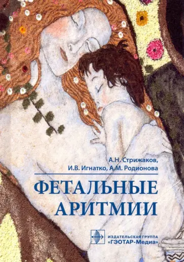 Стрижаков, Игнатко - Фетальные аритмии Стрижаков, Игнатко - Фетальные аритмии обложка книги