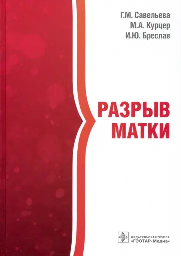 Савельева, Курцер - Разрыв матки Савельева, Курцер - Разрыв матки обложка книги