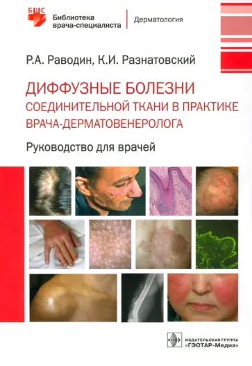 Раводин, Разнатовский - Диффузные болезни соединительной ткани в практике врача-дерматовенеролога Раводин, Разнатовский - Диффузные болезни соединительной ткани в практике врача-дерматовенеролога обложка книги