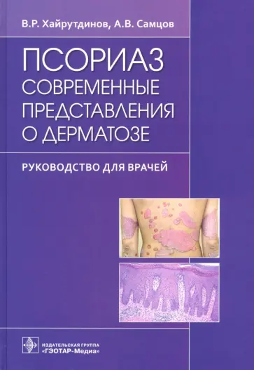 Самцов, Хайрутдинов - Псориаз. Современные представления о дерматозе. Руководство для врачей Самцов, Хайрутдинов - Псориаз. Современные представления о дерматозе. Руководство для врачей обложка книги
