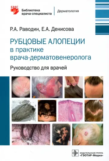 Раводин, Денисова - Рубцовые алопеции в практике врача-дерматовенеролога. Руководство для врачей Раводин, Денисова - Рубцовые алопеции в практике врача-дерматовенеролога. Руководство для врачей обложка книги