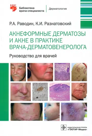 Раводин, Разнатовский - Акнеформные дерматозы и акне в практике врача-дерматовенеролога. Руководство для врачей Раводин, Разнатовский - Акнеформные дерматозы и акне в практике врача-дерматовенеролога. Руководство для врачей обложка книги
