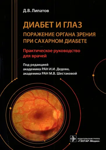 Дмитрий Липатов - Диабет и глаз. Поражение органа зрения при сахарном диабете Дмитрий Липатов - Диабет и глаз. Поражение органа зрения при сахарном диабете обложка книги