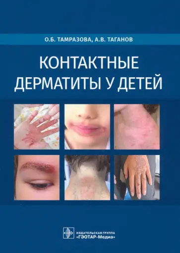 Тамразова, Таганов - Контактные дерматиты у детей Тамразова, Таганов - Контактные дерматиты у детей обложка книги