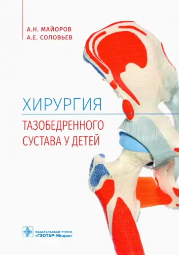 Майоров, Соловьев - Хирургия тазобедренного сустава у детей Майоров, Соловьев - Хирургия тазобедренного сустава у детей обложка книги