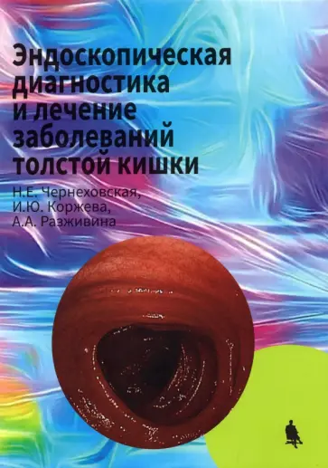 Чернеховская, Коржева - Эндоскопическая диагностика и лечение заболеваний толстой кишки обложка книги