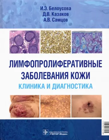 Белоусова, Самцов - Лимфопролиферативные заболеванания кожи. Клиника и диагностика Белоусова, Самцов - Лимфопролиферативные заболеванания кожи. Клиника и диагностика обложка книги