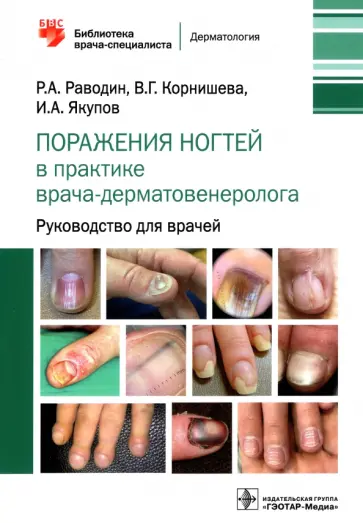 Раводин, Корнишева - Поражения ногтей в практике врача-дерматовенеролога. Руководство для врачей Раводин, Корнишева - Поражения ногтей в практике врача-дерматовенеролога. Руководство для врачей обложка книги