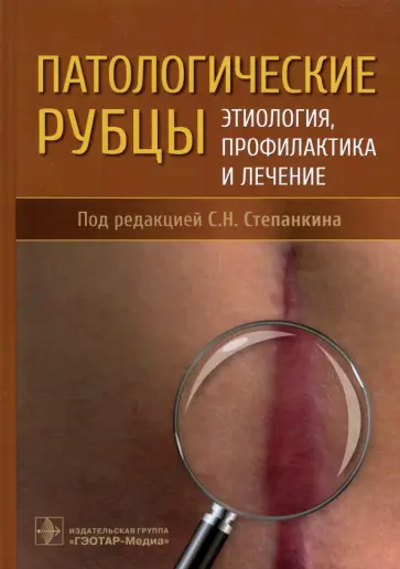 Степанкин, Ахтямов - Патологические рубцы. Этиология, профилактика и лечение Степанкин, Ахтямов - Патологические рубцы. Этиология, профилактика и лечение обложка книги
