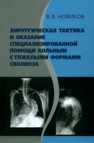 Вячеслав Новиков - Хирургическая тактика и оказание специализированной помощи больным с тяжёлыми формами сколиоза обложка книги