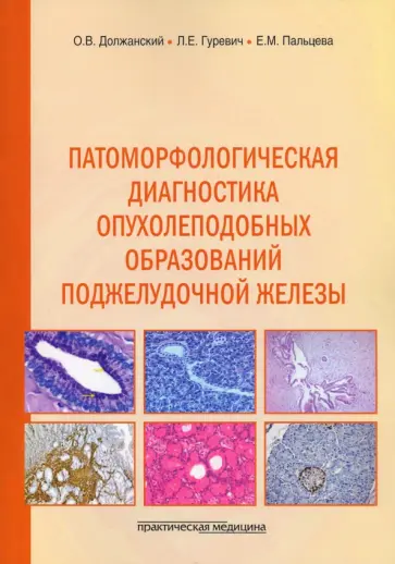 Должанский, Пальцева - Патоморфологическая диагностика опухолеподобных образований поджелудочной железы. Руководство обложка книги