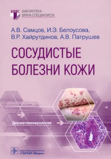 Самцов, Белоусова - Сосудистые болезни кожи. Руководство Самцов, Белоусова - Сосудистые болезни кожи. Руководство обложка книги