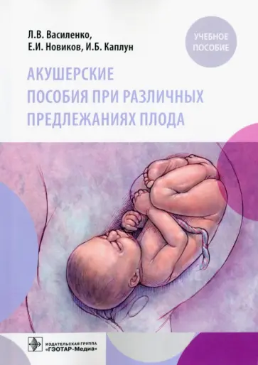 Новиков, Василенко - Акушерские пособия при различных предлежаниях плода. Учебное пособие обложка книги
