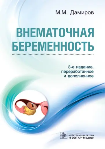 Михаил Дамиров - Внематочная беременность Михаил Дамиров - Внематочная беременность обложка книги
