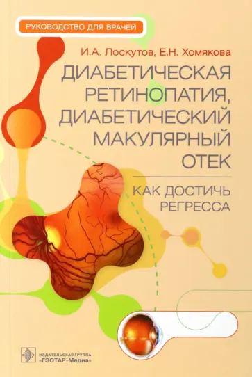 Лоскутов, Хомякова - Диабетическая ретинопатия, диабетический макулярный отек - как достичь регресса. Руководство обложка книги