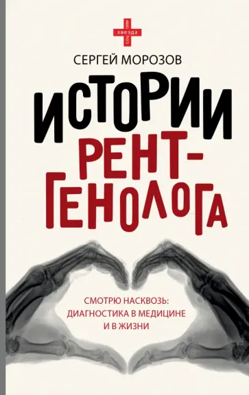 Сергей Морозов - Истории рентгенолога. Смотрю насквозь. Диагностика в медицине и в жизни обложка книги