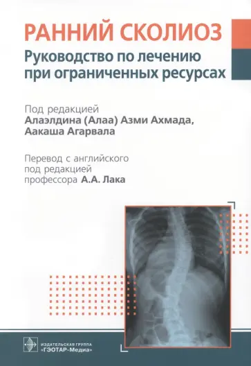 Ахмад, Агарвал - Ранний сколиоз. Руководство по лечению при ограниченных ресурсах Ахмад, Агарвал - Ранний сколиоз. Руководство по лечению при ограниченных ресурсах обложка книги