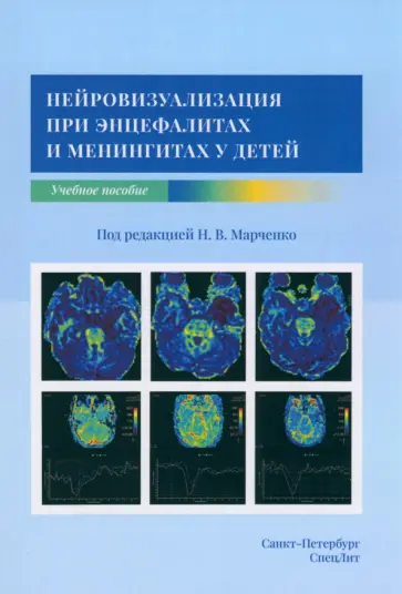 Марченко, Скрипченко - Нейровизуализация при энцефалитах и менингитах у детей. Учебное пособие обложка книги