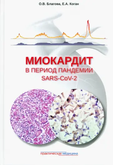 Благова, Коган - Миокардит в период пандемии SARS-CoV-2 Благова, Коган - Миокардит в период пандемии SARS-CoV-2 обложка книги