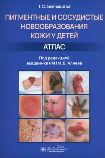 Татьяна Белышева - Пигментные и сосудистые новообразования кожи у детей. Атлас Татьяна Белышева - Пигментные и сосудистые новообразования кожи у детей. Атлас обложка книги