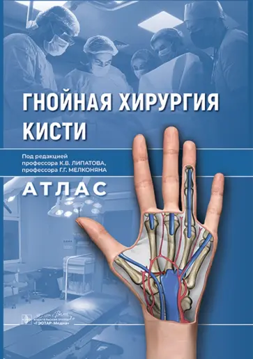 Гнойная хирургия кисти. Атлас Гнойная хирургия кисти. Атлас обложка книги