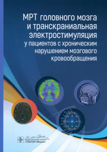 Морозова, Борсуков - МРТ головного мозга и транскраниальная электростимуляция у пациентов с хроническим нарушением Морозова, Борсуков - МРТ головного мозга и транскраниальная электростимуляция у пациентов с хроническим нарушением обложка книги