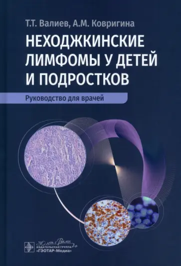 Валиев, Ковригина - Неходжкинские лимфомы у детей и подростков. Руководство для врачей обложка книги