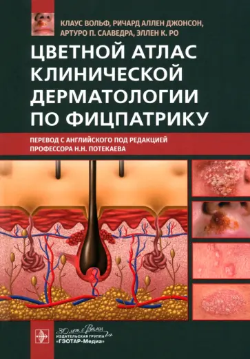 Вольф, Джонсон - Цветной атлас клинической дерматологии по Фицпатрику обложка книги