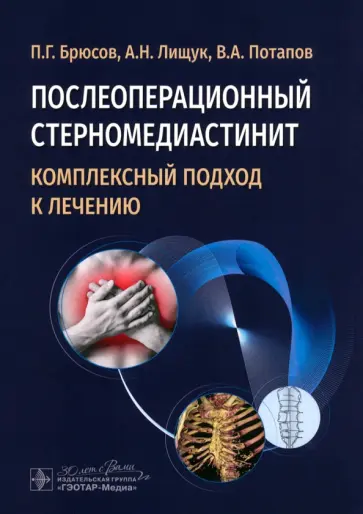 Брюсов, Лищук - Послеоперационный стерномедиастинит. Комплексный подход к лечению Брюсов, Лищук - Послеоперационный стерномедиастинит. Комплексный подход к лечению обложка книги