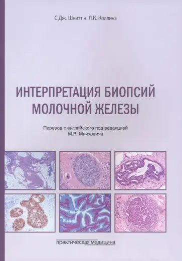 Шнитт, Коллинз - Интерпретация биопсий молочной железы обложка книги
