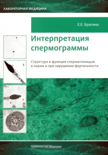 Елизавета Брагина - Интерпретация спермограммы. Структура и функция сперматозоидов в норме и при нарушении фертильности обложка книги