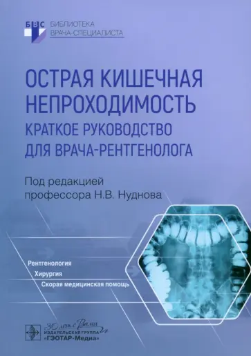 Нуднов, Ардюкова - Острая кишечная непроходимость. Краткое руководство для врача-рентгенолога Нуднов, Ардюкова - Острая кишечная непроходимость. Краткое руководство для врача-рентгенолога обложка книги