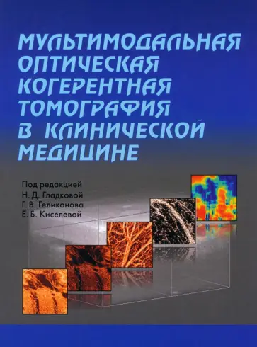 Гладкова, Геликонов - Мультимодальная оптическая когерентная томография в клинической медицине обложка книги